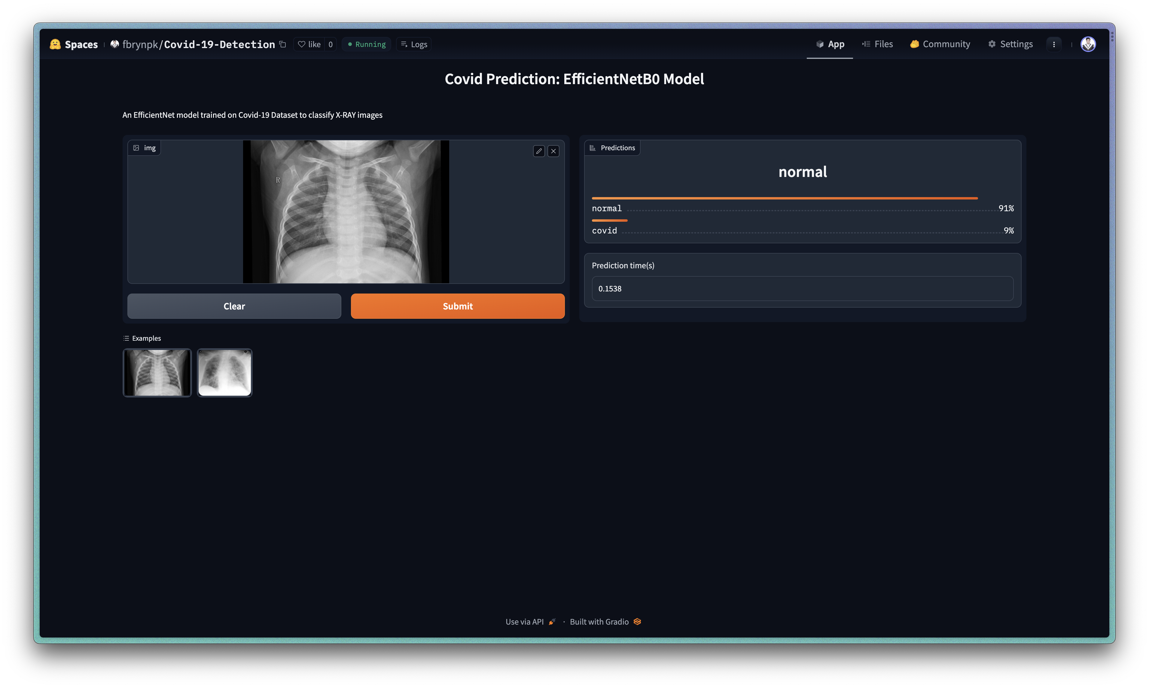 Pneumonia Detection